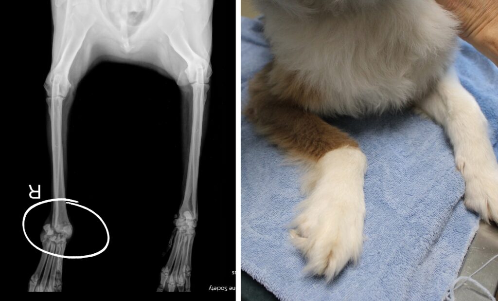 Fletcher's X-Ray and broken foot